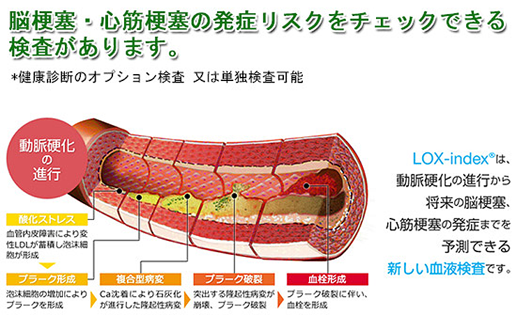 人間は血管と共に老いる
