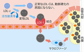 動脈硬化のメカニズム